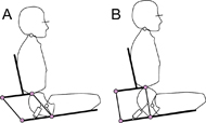 A concept for independent pelvic rotation. Actuating the parallelogram in the sagittal plane imposes pelvis posterior- (A) and anterior tilt (B). 